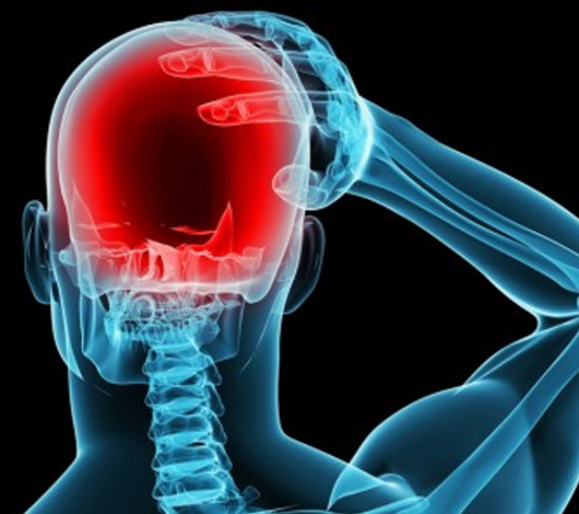 Traitement des migraines
