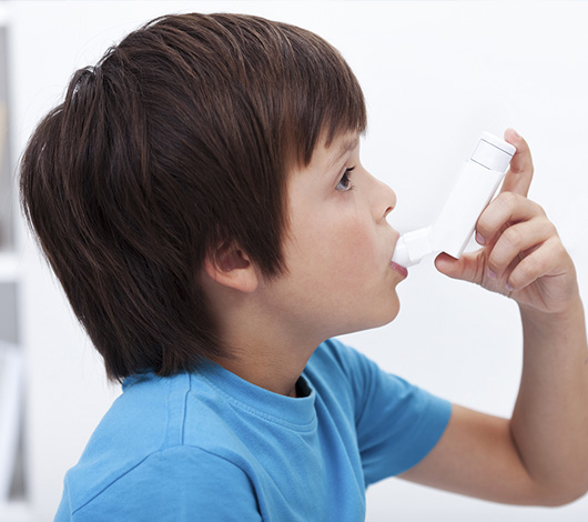 Traitement de l'asthme par l'ozonothérapie