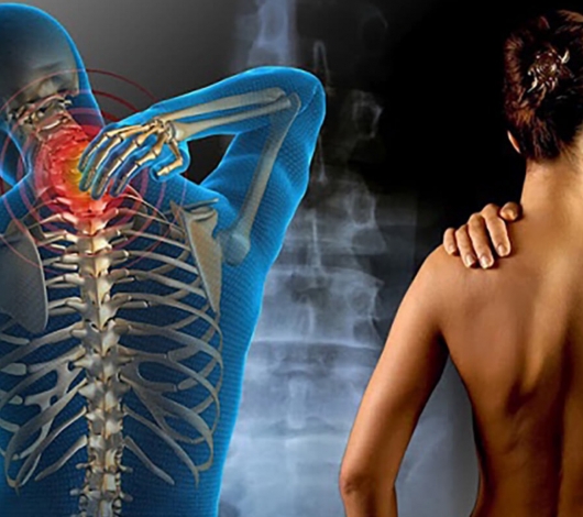 OZONOTHERAPIE ET FIBROMYALGIE